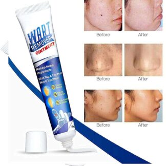 Wart Remover Skin Tag Cream